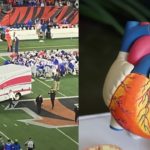 Did Damar Hamlin Suffer Commotio Cordis Cardiac Arrest Before Collapsing on the Field?