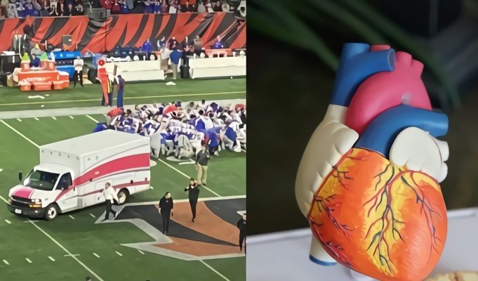 Did Damar Hamlin Suffer Commotio Cordis Cardiac Arrest Before Collapsing on the Field?