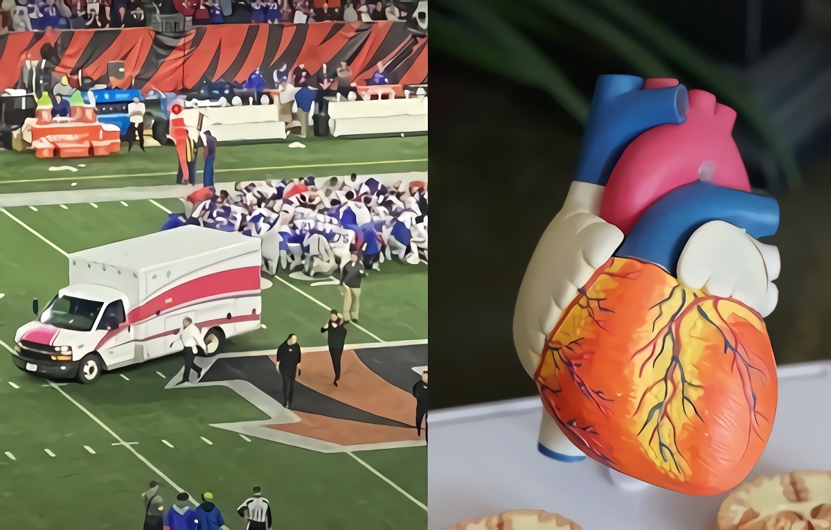 Did Damar Hamlin Suffer Commotio Cordis Cardiac Arrest Before