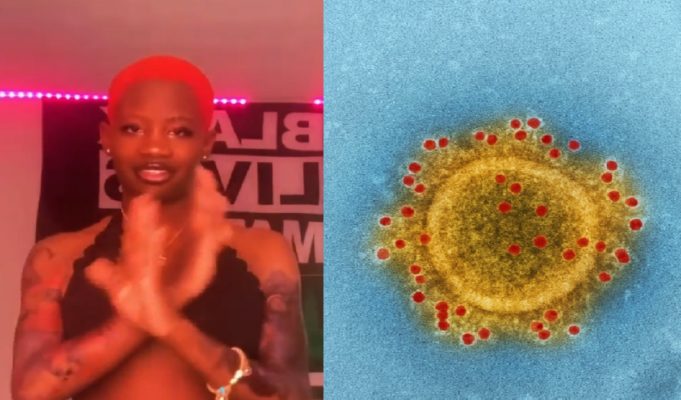 How Did Georgia IG Model Doseofcaam Contract Monkeypox? Video Shows Instagram Model’s Monkeypox Infection Causing Giant Blisters On Her Face