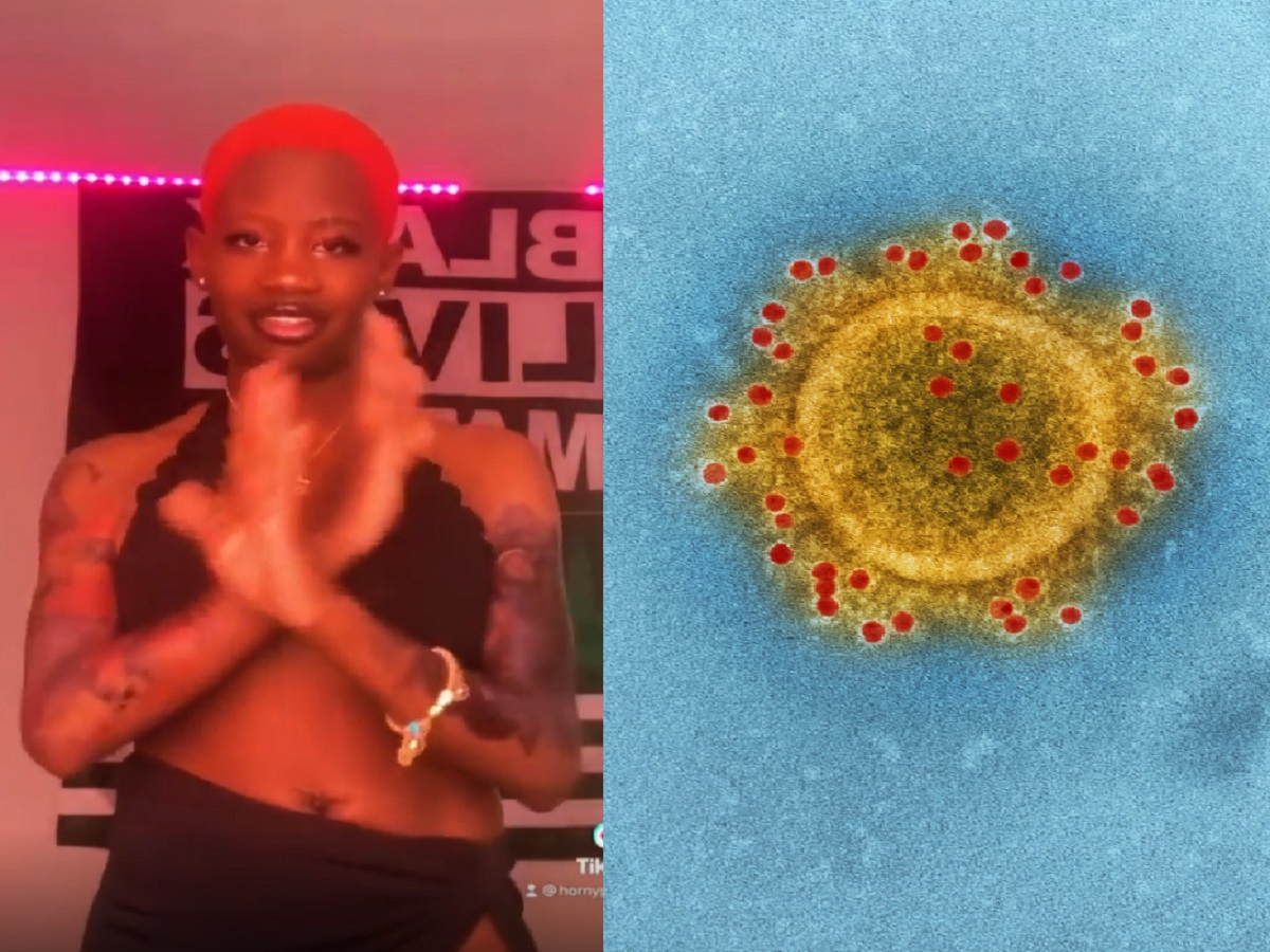 How Did Georgia IG Model Doseofcaam Contract Monkeypox? Video Shows Instagram Model’s Monkeypox Infection Causing Giant Blisters On Her Face