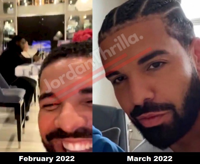 Drake's fake braid hair compared with his real hair side by side.