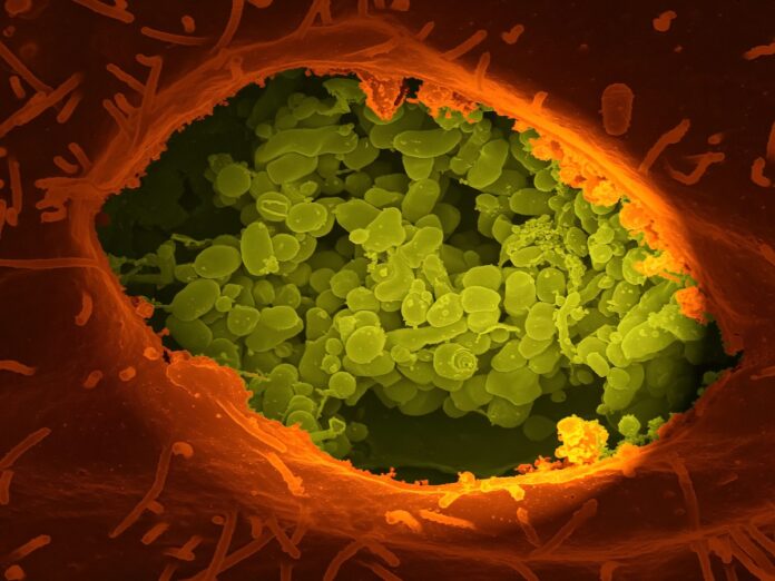hurricane-ian-flesh-eating-bacteria