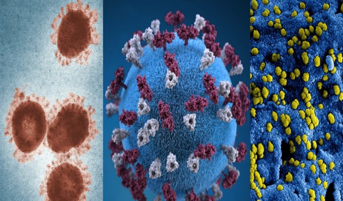 Details on How an Italian Man Contracted Monkeypox, HIV, and COVID at the Same Time During a Vacation Trip