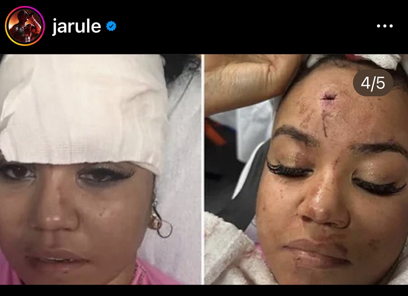 Ja Rule Uses Bryhana Monegain's Injury to Respond 50 Cent Clowning His Jesus Crucifixion Nailed to the cross Performance
