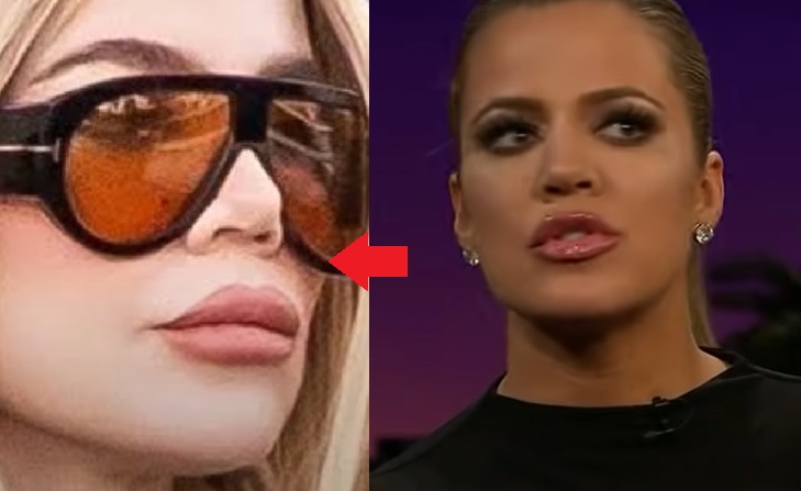Khloe Kardashian collapsed nose compared with older nose