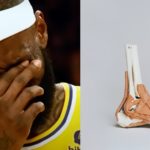 Does Lebron James Need Right Ankle Surgery for Arthritis? Skip Bayless' Claim Leaves Lakers Fans in Shambles
