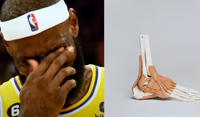 lebron-james-ankle-surgery-rumor-skip-bayless