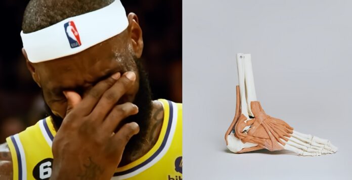 lebron-james-ankle-surgery-rumor-skip-bayless