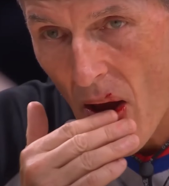 Did Lebron James Hit Scott Foster on Purpose Leaving Him Bleeding? Scott Foster's 'You've been wanting to do that for 25 years' Reaction Fuels Speculation
