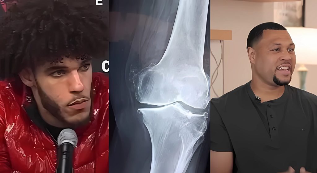 Lonzo Ball knee compared to Brandon Roy after announcement he's out for 2023 NBA season