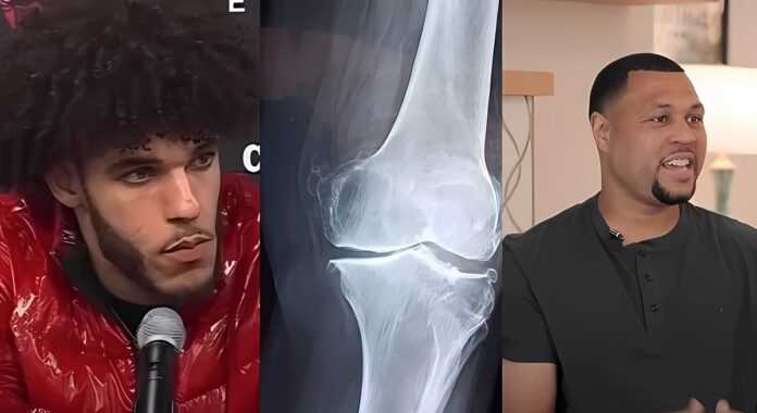 lonzo-ball-knee-brandon-roy-injury