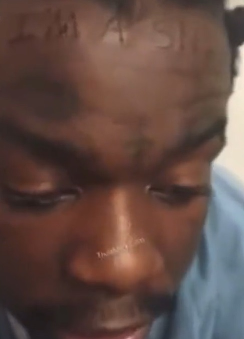 Man Forced to Get 'I'm a Snitch' Tattoo on His Forehead in Prison After Snitching on His Friend