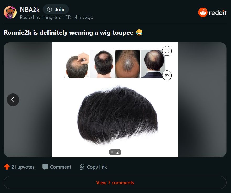 Alleged photo showing Ronnie2K Wearing a a Wig Toupee