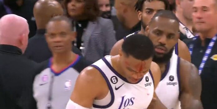 russell-westbrook-bleeding-injury-zach-collins