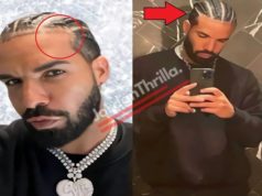 Is Drake Wearing Hair Weave Braids? Evidence Inside
