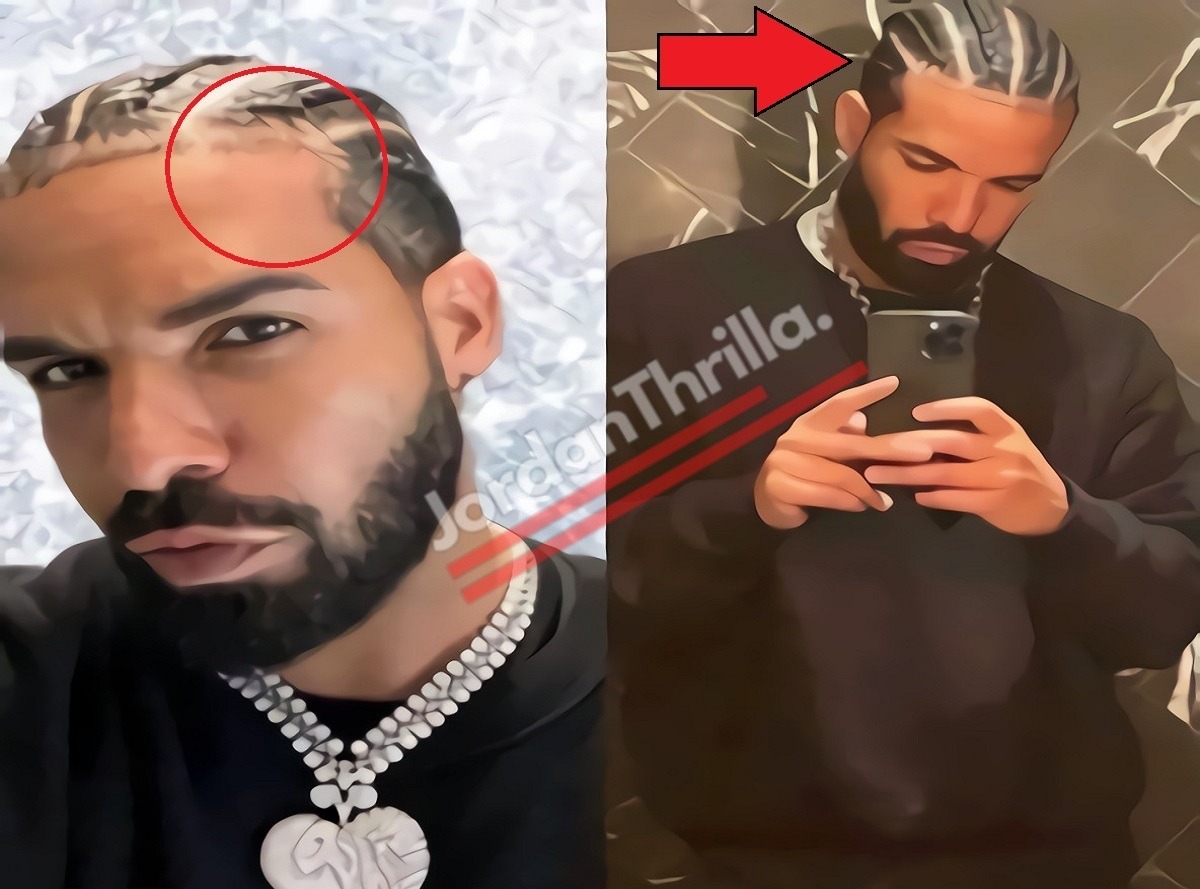 Evidence showing Drake's hair weave braids.