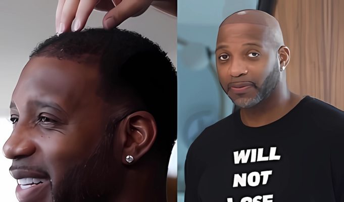 Does Tracy McGrady Have Fake Hair? Tracy McGrady's Hair Transplant Video Trends on Social Media
