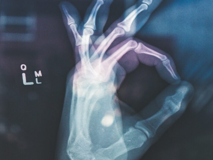 tyler-herro-hand-surgery-botched-conspiracy
