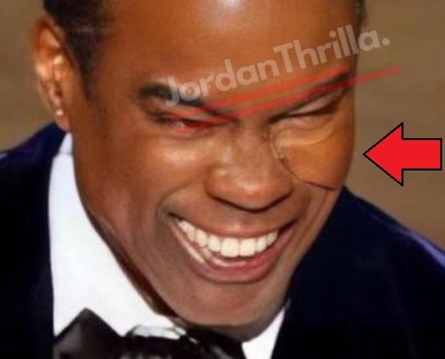 Chris Rock cheek pad photo proving Will Smith slapping Chris Rock was staged.