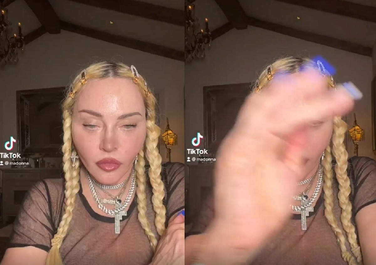 Madonna's Plastic Surgery Face and Lips Video Has Fans Worried About her Mental Health