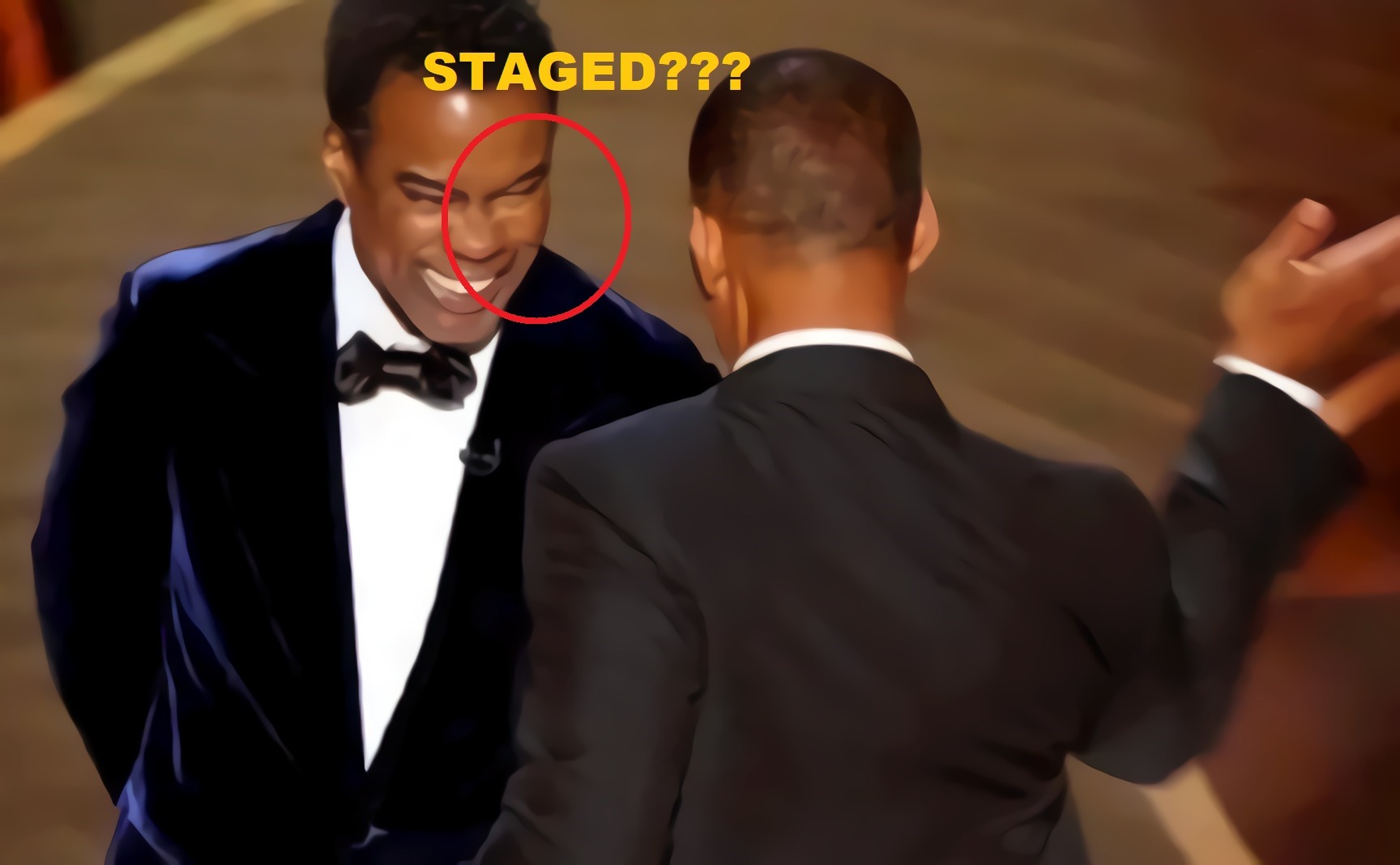 Photo of Chris Rock wearing cheek pad when Will Smith slapped him.