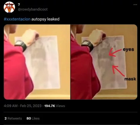 Did XXXTentacion's Autopsy Photos Leak on Social Media?